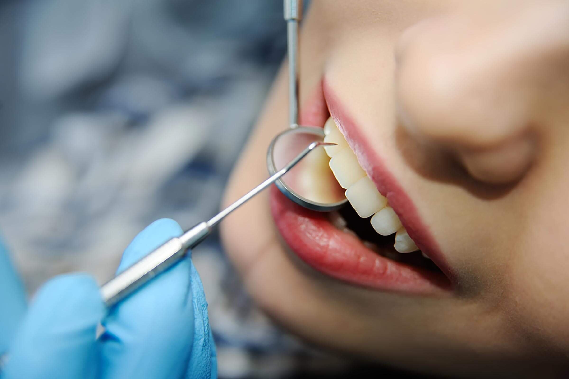 5 Secrets Your Dentist Doesn't Want You to Know